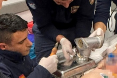 Hatay'da 2 yaşındaki çocuk elini kıyma makinesine kaptırdı
