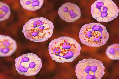 Gana'da menenjit salgını! Çok sayıda ölü...