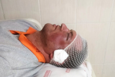 Zonguldak'ta temizlik işçisi görevi başında saldırıya uğradı