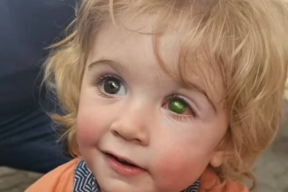 Bir öpücük 2 yaşındaki çocuğu kör etti!