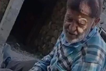 Tokat'ta otları temizlemek isterken yanarak can verdi