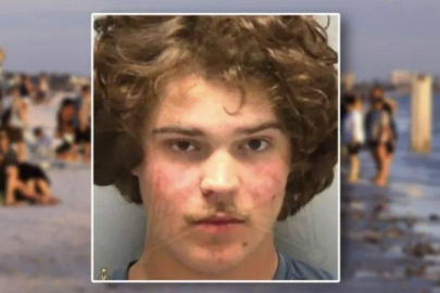 Plajda ırkçı saldırı: Kulağı ısırılarak koparıldı