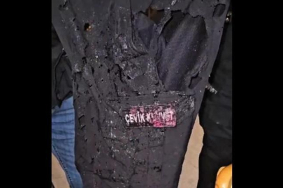 Saraçhane'de polise asitli saldırı! Üniforması eridi