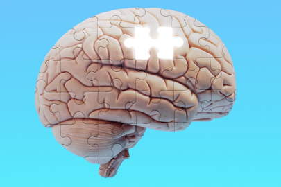 Sessiz tehlike: Beyin implantları bakterilere kapı aralıyor