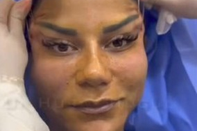 Antalya'da 220 bin TL'ye estetik oldu, hayatı kabusa döndü