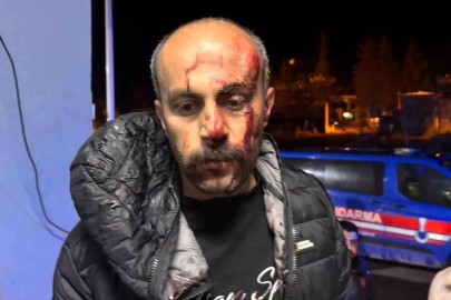 Avukata polis darp iddiası