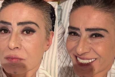 Yıldız Tilbe'den yeni imaj: Yaralarım geçmeyecekti