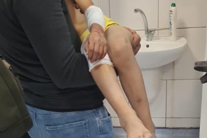 Başıboş köpekler 9 yaşındaki çocuğa saldırdı