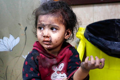 BM: Gazze'de 60 binden fazla çocuk gıda kıtlığıyla mücadele ediyor