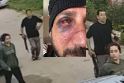 Sevgilisinin ailesini icraya verdi, öldüresiye darp edildi!