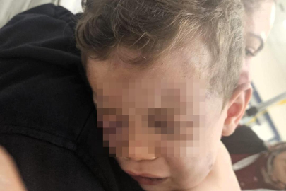 Vahşet:  2 yaşındaki bebek darp edildi!