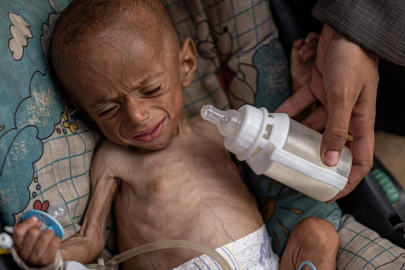 İsrail'in yardım girişini engellediği Gazze'de 3 bin 500 çocuk açlıktan ölebilir