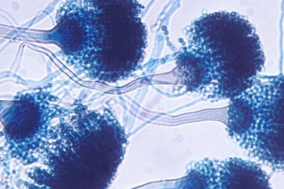 Bilim insanları alarma geçti: Milyonlarca insanı öldürebilir!