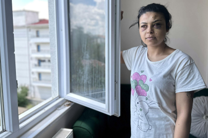 Düğünde maganda dehşeti: Saçmalar gözüne isabet etti