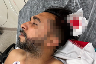 Adana'da döner ustası çalışırken başından yorgun mermiyle yaralandı