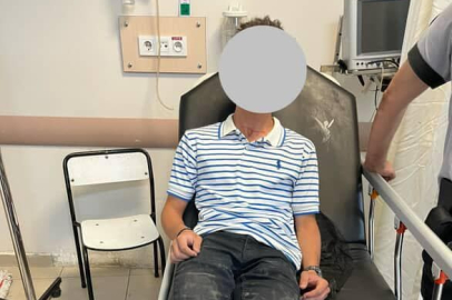 Kastamonu'da başıboş köpeğin saldırısına uğrayan motosikletli kurye yaralandı