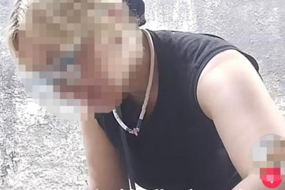 Sosyal medyada tepki çeken skandal görüntü! Kedilere iğne...