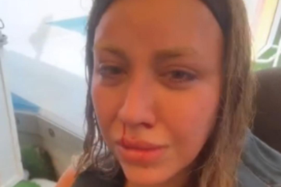 Mika Raun kanlar içinde kaldı