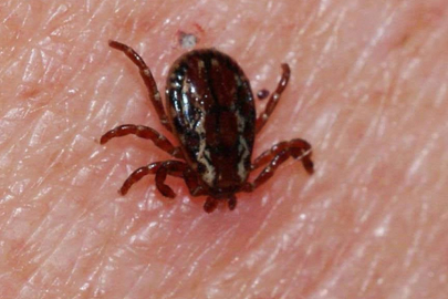 Sivas'ta KKKA hastalığı şüphesiyle tedavi gören kişi öldü