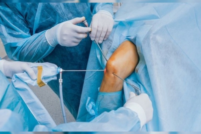 Bursa'da 2 yaşındaki bebeğin böbreğindeki taş kapalı yöntemle alındı