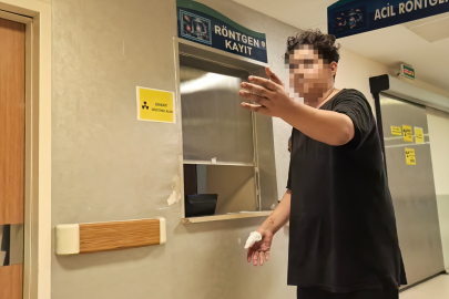 Bursa’da motosiklet zincirine elini kaptıran gencin parmağı koptu