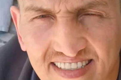 İstanbul'da burun estetiği ameliyatının ardından hayatını kaybetti