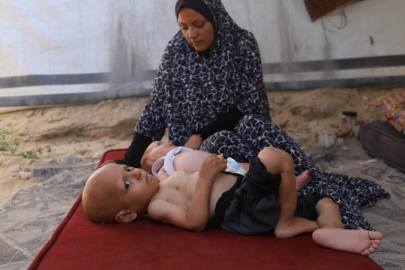 Gazze'de çocuklar "açlıktan ağlıyor"