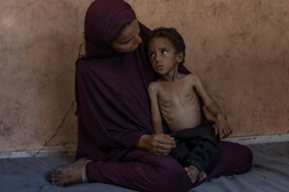 Gazze’de 86 kişi açlıktan hayatını kaybetti