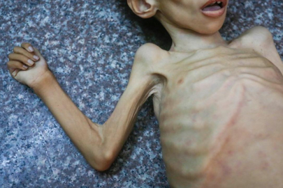 Gazze'de bir çocuk daha açlık nedeniyle hayatını kaybetti