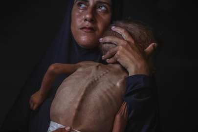 Gazze'de bir bebek daha açlıktan hayatını kaybetti