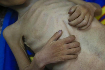 Gazze'de son 24 saatte 6 kişi daha açlıktan hayatını kaybetti