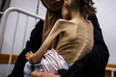 Gazze’de 9 yaşındaki Meryem, 25 kilodan 10 kiloya düştü