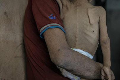 Gazze Şeridi'nde son 24 saatte ikisi çocuk, 5 kişi daha açlıktan hayatını kaybetti