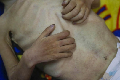 Gazze'de son 24 saatte 5 kişi daha açlıktan hayatını kaybetti