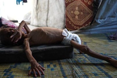 Gazze’deki ABD'li hemşire: İsrail soykırımı Gazze'yi yok ediyor, çocuklar açlıktan ölüyor