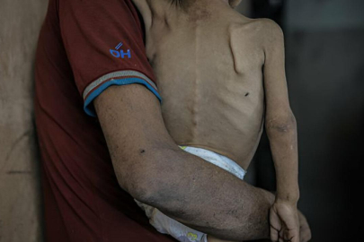 İsrail'in kıtlığı dayattığı Gazze’de açlıktan ölenlerin sayısı 263’e yükseldi