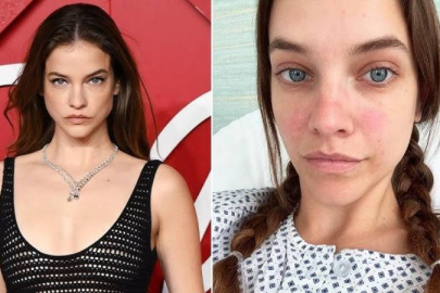 Süper model Barbara Palvin gizli hastalığını açıkladı