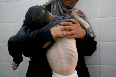 Soykırımcı İsrail'in kıtlığı dayattığı Gazze’de 2 Filistinli daha açlıktan hayatını kaybetti