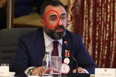 TBMM’deki komisyona damga vuran an! Gözünü çıkartıp anlattı...