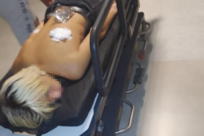 Aydın Kuşadası'nda gaspçılar çocuğu sırtından bıçakladı