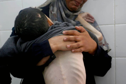 Gazze'de açlıktan ölenlerin sayısı 339'a çıktı