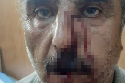 Denizli'de doktor ile emekli öğretmenin mesai kavgası karakolda bitti