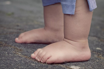 Dünyada ilk kez obez çocuk sayısı zayıfların sayısından fazla