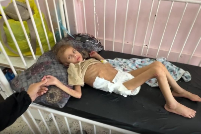 Gazze’de yetersiz beslenme sonucu 12 kiloya düşen 7 yaşındaki May yürüme yetisini kaybetti