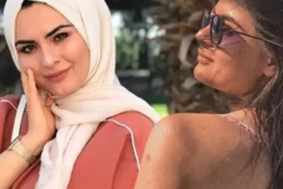 Gelin adayı Hanife resmen eridi: Boşanma yaradı, zayıflık yakışmış