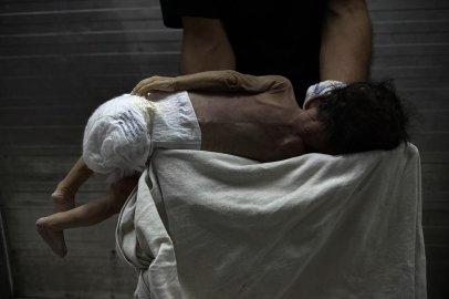 Soykırımcı İsrail'in kıtlığı dayattığı Gazze'de 453 kişi açlıktan hayatını kaybetti
