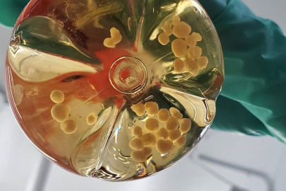 Laboratuvarda geliştirilen mini beyinler: Bilinç kazanırlarsa ne olacak?