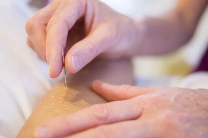 Aile hekiminde akupunktur fiyatı belli oldu!