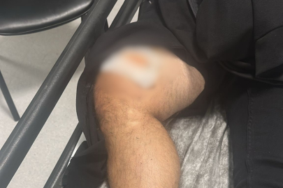 Muğla Marmaris’te silahlı kavga: 1 yaralı