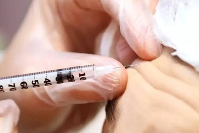 Botoks yaşı 15'e düştü! Mükemmellik tuzağına düşüyorlar...